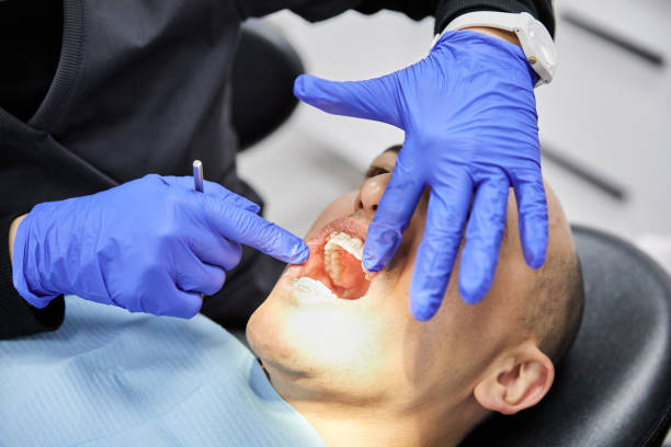 Best Chipped Tooth Repair Near Me  in Edgewood, IN