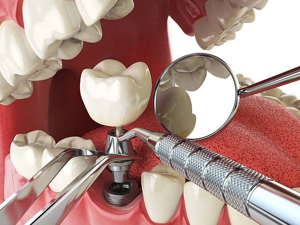 Best Emergency Tooth Extraction  in Edgewood, IN